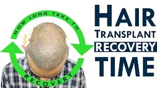 Hair Transplant Recovery Time?  ||  How Long Does It Take To Recover From Hair Transplant ?