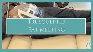 TruSculptID Fat Melting