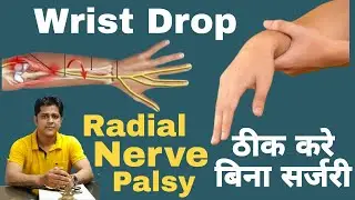 Physiotherapy Exercise For Wrist Drop.Wrist Drop का ईलाज। Radial nerve palsy.#wristdrop #wristpain
