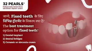 Fix Missing Teeth Permanently | Implant vs Bridge Explained