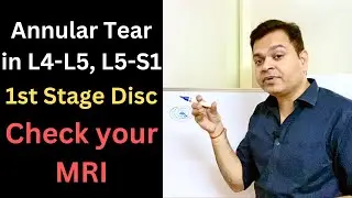 What is Annular Tear, Disc Bulge L4-L5, Slipped Disc, Lumbar Spine MRI, Low Back Pain Causes