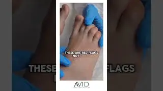 Think Your Feet Are Fine? Watch This. #Podiatrist #Podiatry #FootPain