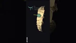 ASI TE DISE&Ntilde;O TU DIENTE PERDIDO