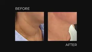 Med Aesthetics Miami February 2026 Offer