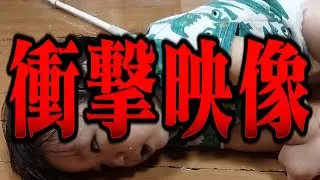 【貴重映像】子どもの危険な状態。突然、白目で痙攣…消防レスキューがてんかんのリアルを徹底解説。