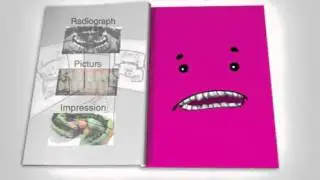 ClearPath Aligners   Patient Education Animation