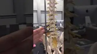 Spinal Cord