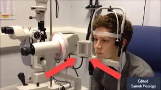 javal keratometry : how to use?