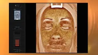 How the Sun's Rays Can Affect Your Skin