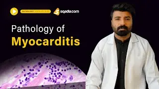 Pathology of Myocarditis | Medical Lecture