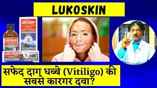 सफेद दाग धब्बे हटाने की दवा Aimil Lukoskin। Safed Daag Ka ilaj | Medicine For Vitilgo & Leucoderma