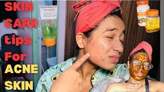 HOW TO REMOVE PIMPLES NATURALLY AT ||HOME ||🏠#skincare #pimple 