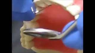 Probe