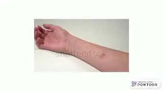 tb5