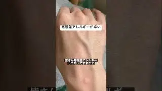 寒暖差アレルギーが辛い　#shorts
