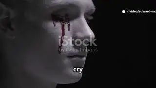 A man who was born with 2 faces