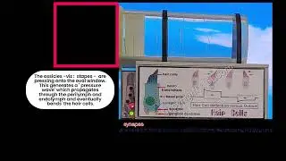 How Hair Cells function in Cochlear Final 6 of 6
