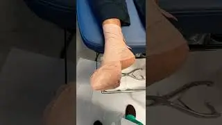 Wrapping the foot for Qutenza