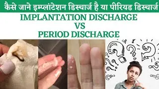 IMPLANTATION DISCHARGE VS PERIOD DISCHARGE | DIFFERENCE BETWEEN IMPLANTATION & PERIOD DISCHARGE