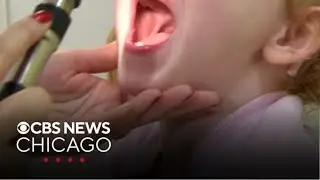 Health experts say children remain highest risk group for flu | Health Watch