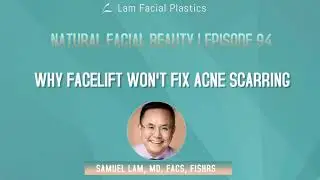 Dallas Cosmetic Surgery Podcast: Why Facelift Won't Fix Acne Scarring