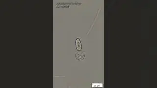 Ciliate budding - time-lapse microscopy - compost microbe