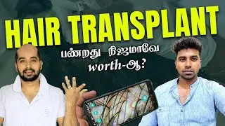 PART 1 | FIRST time Hair Transplant Try பண்ண போறேன் |கைகுடுக்குமா Technology | JUUJEE VLOGS
