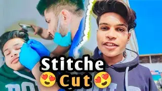 Finally Surgery Ke Taake Cut Ho Hi Gaye 😍|| Sumit07 Vlogs