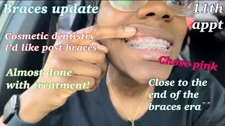 Braces update - after appointment 11