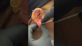 Stacked lobe piercing with titanium gold jewelry ✨