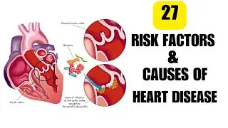 27 Risk Factors and Causes of Heart Disease You Might Not Be Aware of