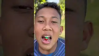 Yummy Bites 🍓Chocolate 🍫ball nuggets eating by #villagee #viral #shorts #satisfying #fypシ