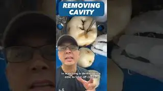 Why it&rsquo;s Important to Remove a Cavity (Preventing Dental Problems) | View Mobile Dental #shorts