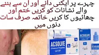 Acsolve lotion and gel for acne/clindamycin phosphate/How to use acsolve gel and lotion complete rev