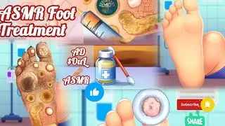 Oddly Satisfying ASMR Foot Cleaning! 🦶💉 Extreme Callus & Infection Removal | AD $OuL🩹ASMR