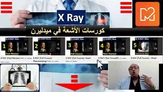 Radiology (X-Ray) Courses   #usmle #internal_medicine #cme  #محاضرات_باطنة #medlearn #medicalcollege
