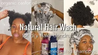 3 STEP NATURAL HAIR WASH for dandruff with medicated shampoo Nizoral, Dermarest for scalp psoriasis