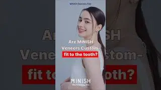 Are MINISH Veneers Truly Custom Fit? (Down to the Micron)