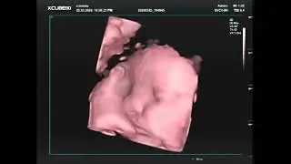 31 Weken Zwanger 3D Filmpje