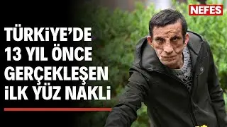 Türkiye'de ilk yüz nakli olan Uğur Acar, 13 yılda hayallerine de kapı araladı