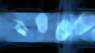 Vortex Flow Measuring Principle