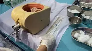 pemasangan KB IUD