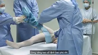 04P17 ViPhaCo Bộ khăn nội soi khớp gối