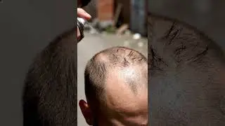 Instant Hair Growth Hack You Have to See #asmr #barber #haircare