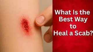 What Is the Best Way to Heal a Scab?