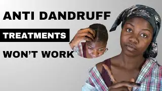 How to Treat Dandruff the Right Way (Beginner-Friendly Guide)