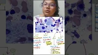 Lysosomal Storage Disorders from a clinical POV. High yield PYT. #neetpg2026 #biochem #pyqs