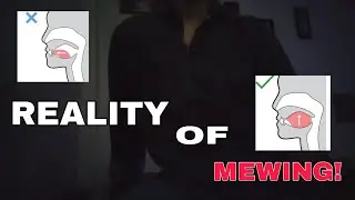 SAD REALITY OF MEWING ! MUST WATCH 🚨 | AKSH4T