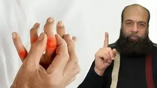 Mineral Deficiency Causing Arthritis | Arthritis Causes & Joint Pain Treatment in Urdu/Hindi