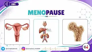 74. Menopause | Obstetrics & Gynecology for USMLE Step 2 CK | Symptoms, Hormonal Changes, Management